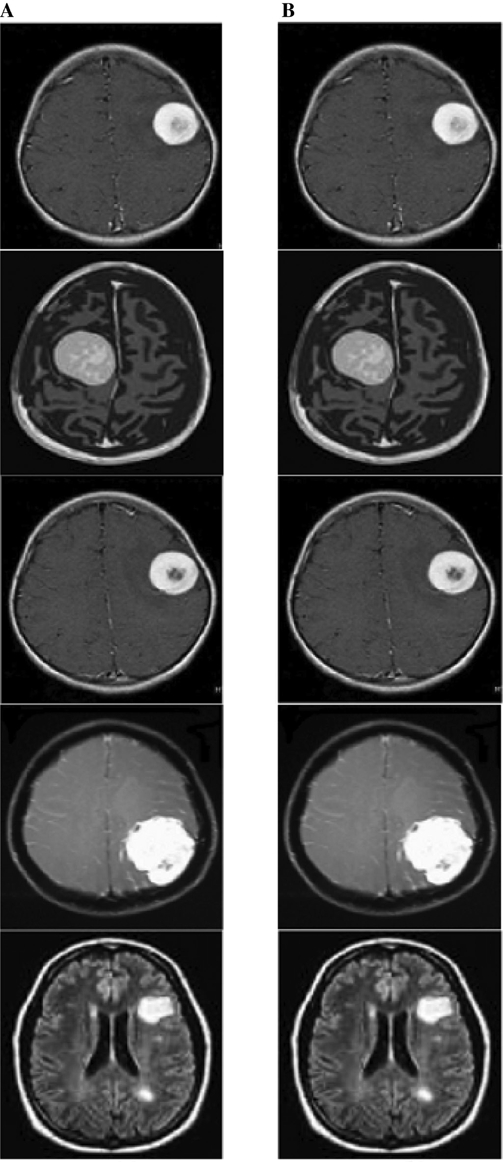 Figure 6: Experimental Output.(A) Input image. (B) Watermarked image.