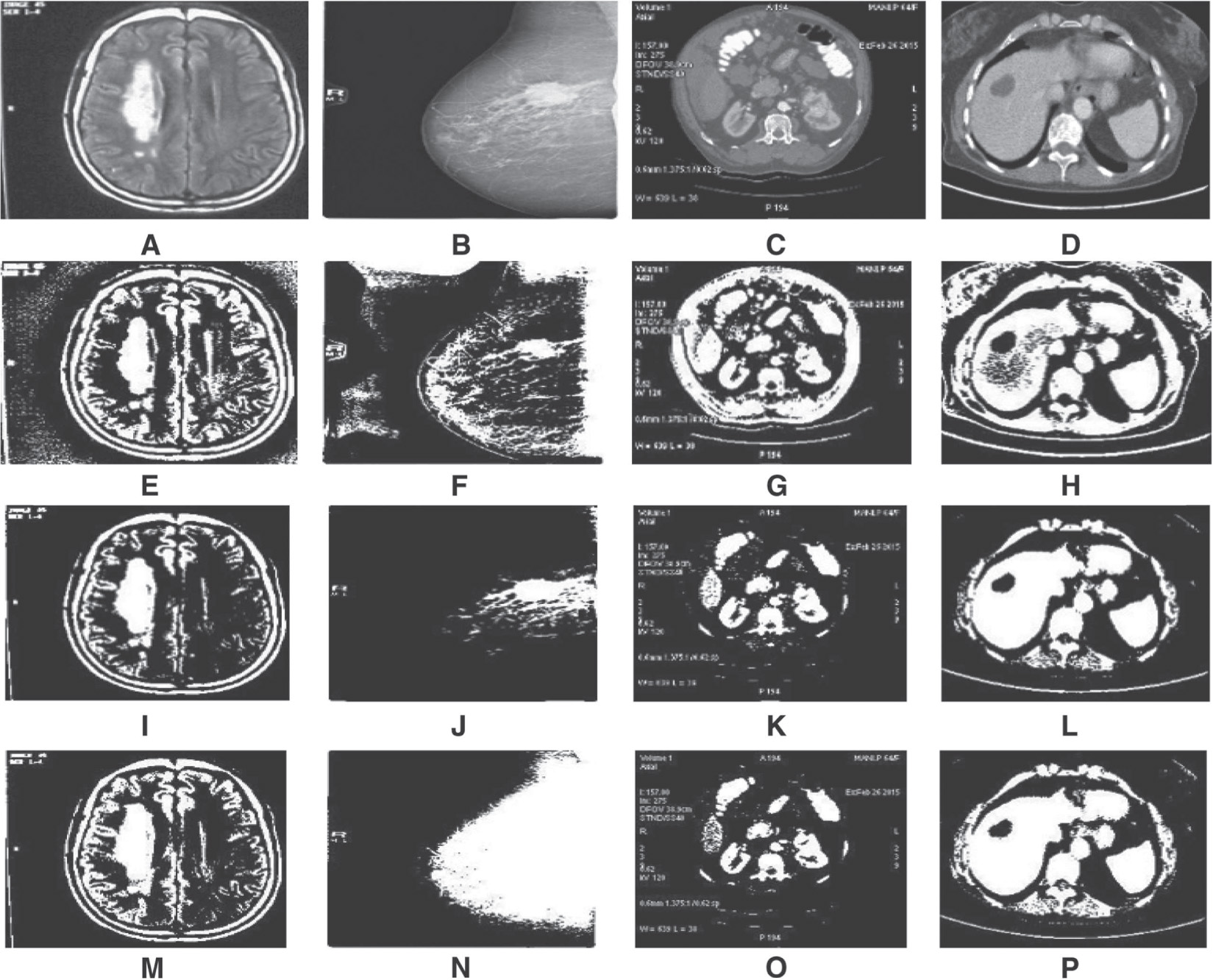 Figure 2: Row 1: Input Images; Row 2: Adaptive Thresholding Output; Row 3: Maximum Entropy Thresholding Output; Row 4: Local Statistics Thresholding Output.