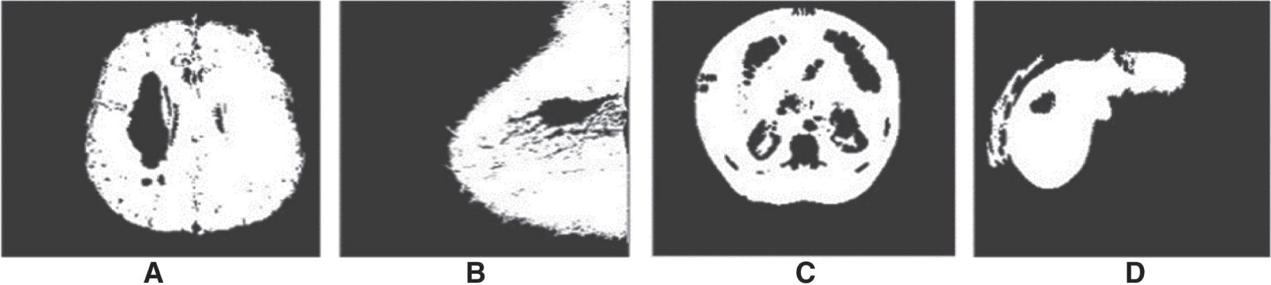 Figure 3: Region Growing Algorithm Segmentation Result.
(A) (x, y) = (195, 145), (B) (x, y) =  (175, 122), (C) (x, y) = (163, 103), (D) (x, y) = (80, 93).