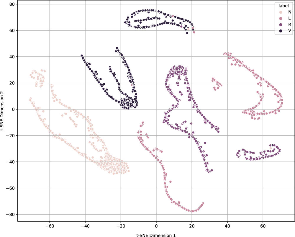 Figure 5
t-SNE visualization of the four classes N, L, R, and V.