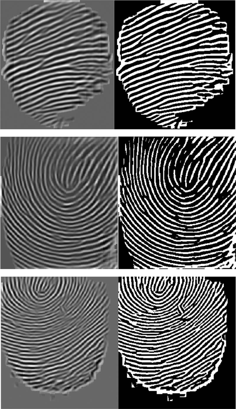 Figure 7 
                  Left: enhanced fingerprint image. Right: binarized fingerprint image.
               
