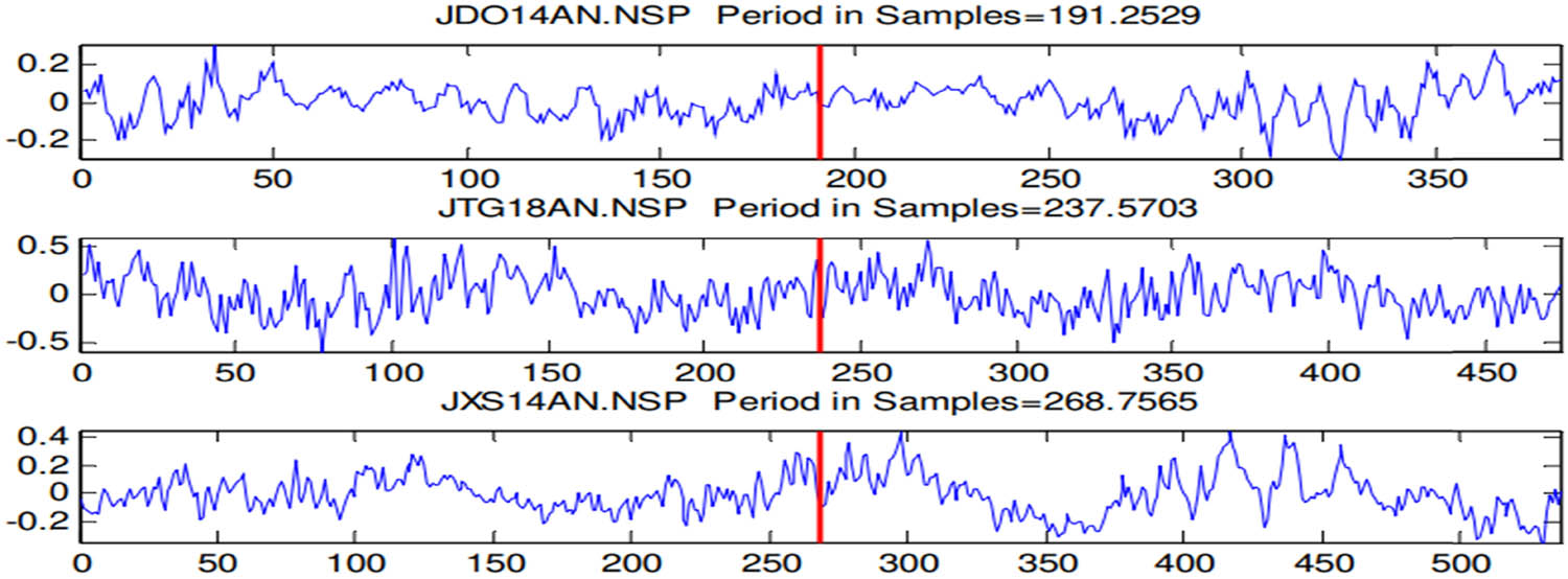 Figure 1 
                  Three types of signal examples from the MEEI database [15].
               
