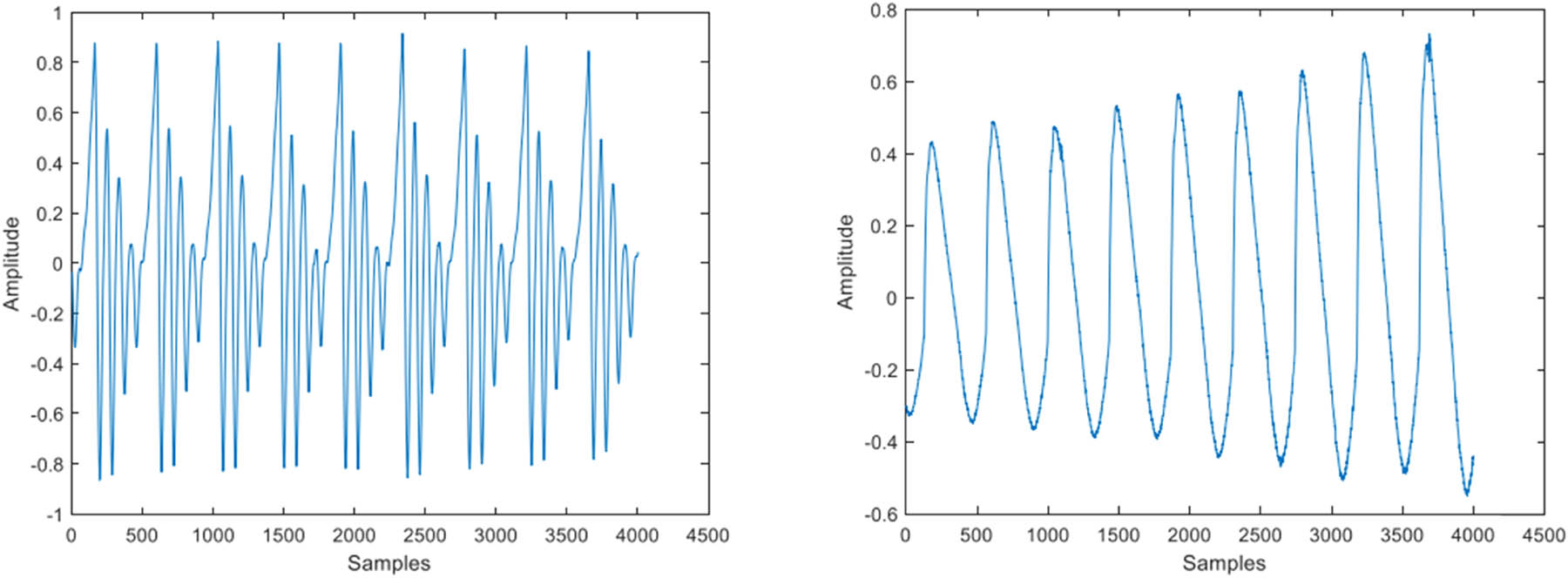 Figure 2 
                  Voice and EGG signal examples from the SVD database [13].
               