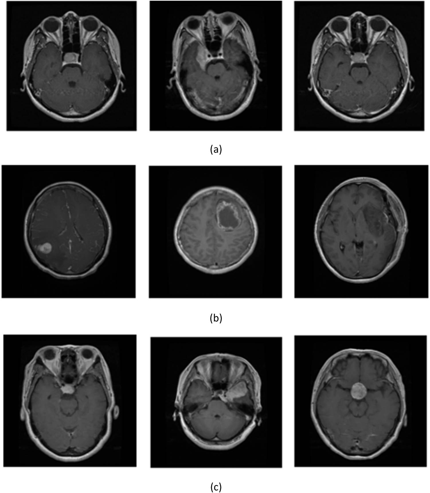 Figure 4 
                  Sample images of (a) pituitary, (b) glioma, and (c) meningioma.
               