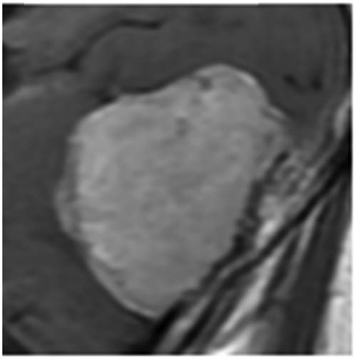 Figure 8 
               Cropped input image.
            