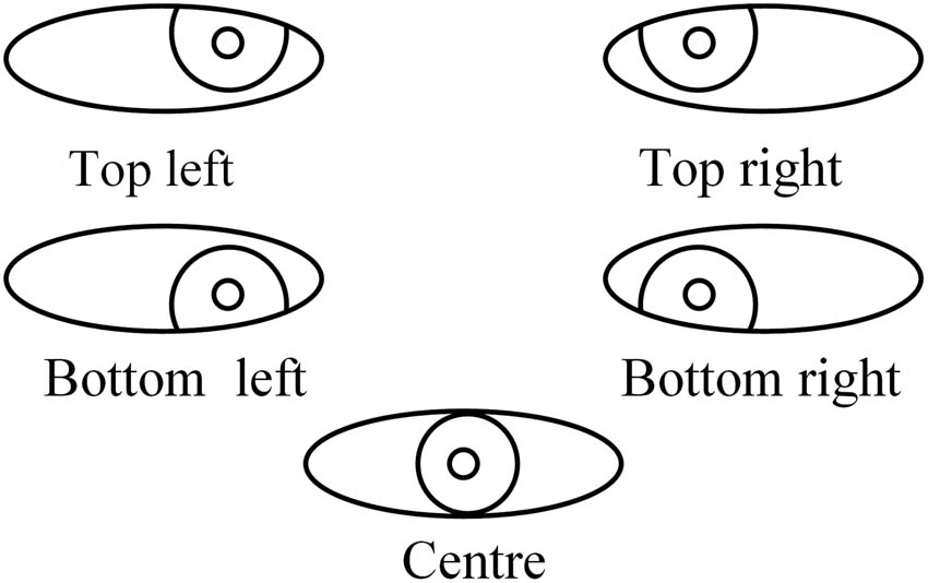 Figure 2
Sight landing situation.