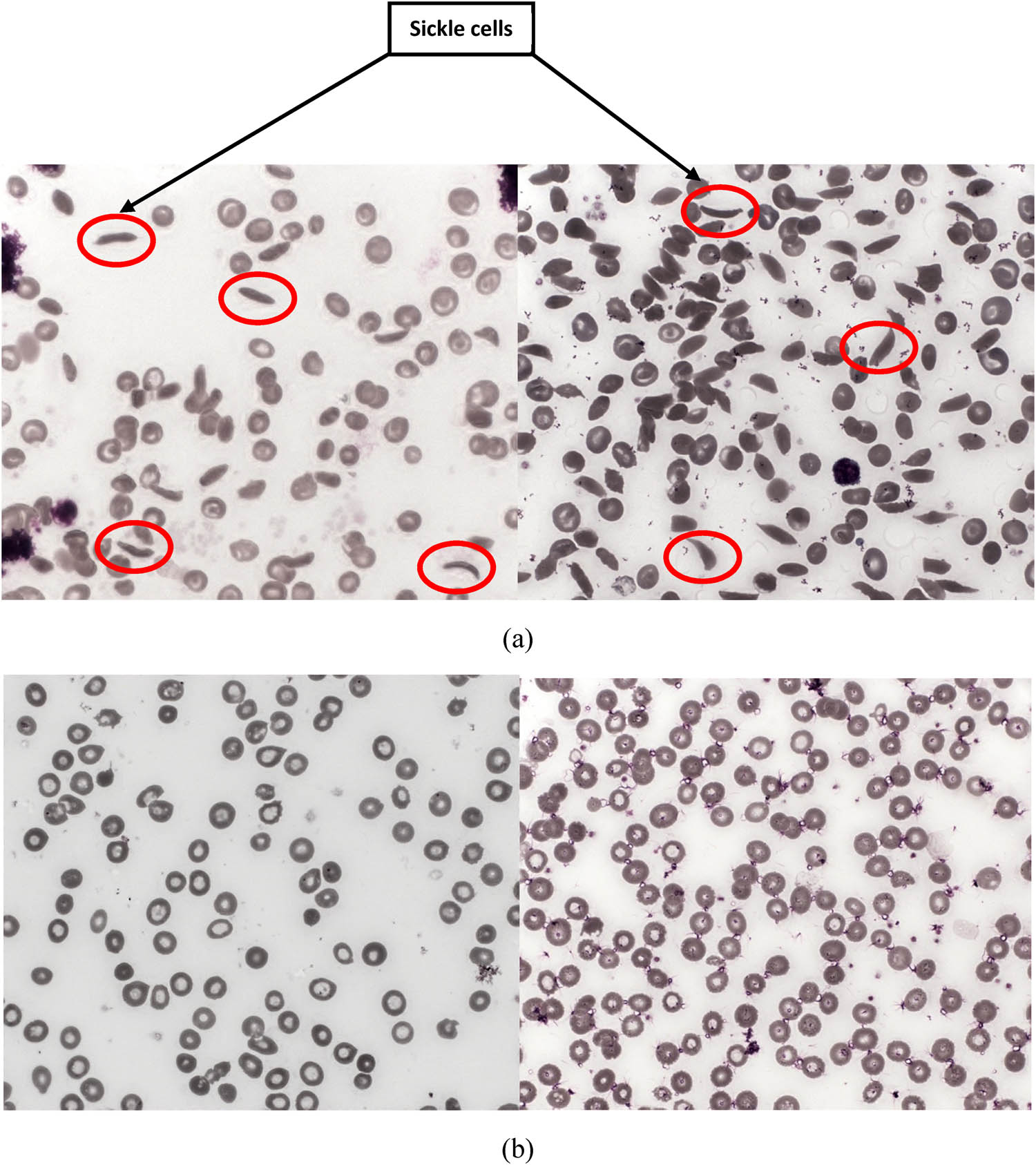 Figure 4
(a) Sickle cell image dataset and (b) other class dataset.