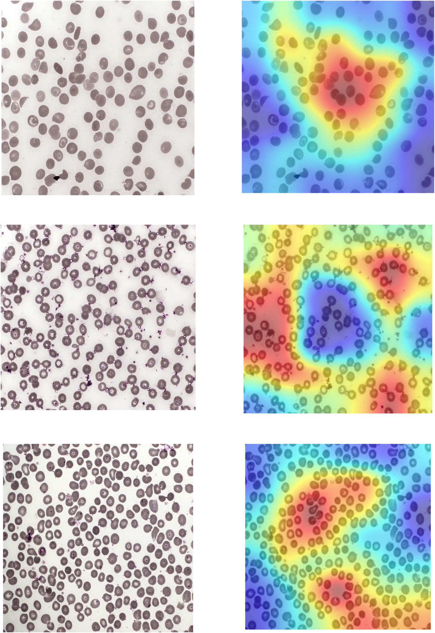 Figure 14
Non sickle class images under Grad-CAM.