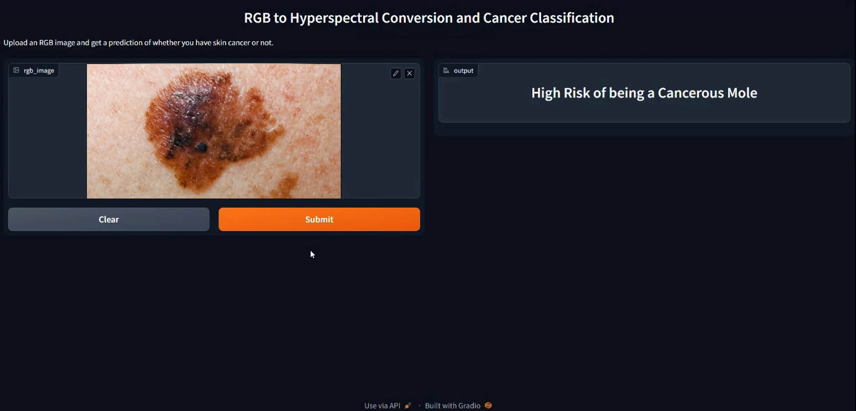 Figure 9 
                  Inserted RGB image with classification result in Gradio interface.
               