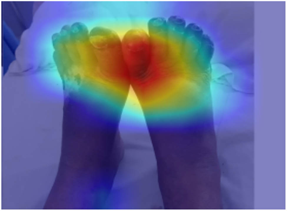 Figure 4 
                  Heatmap for our model. Source: Proposed, created and drawn by the authors.
               