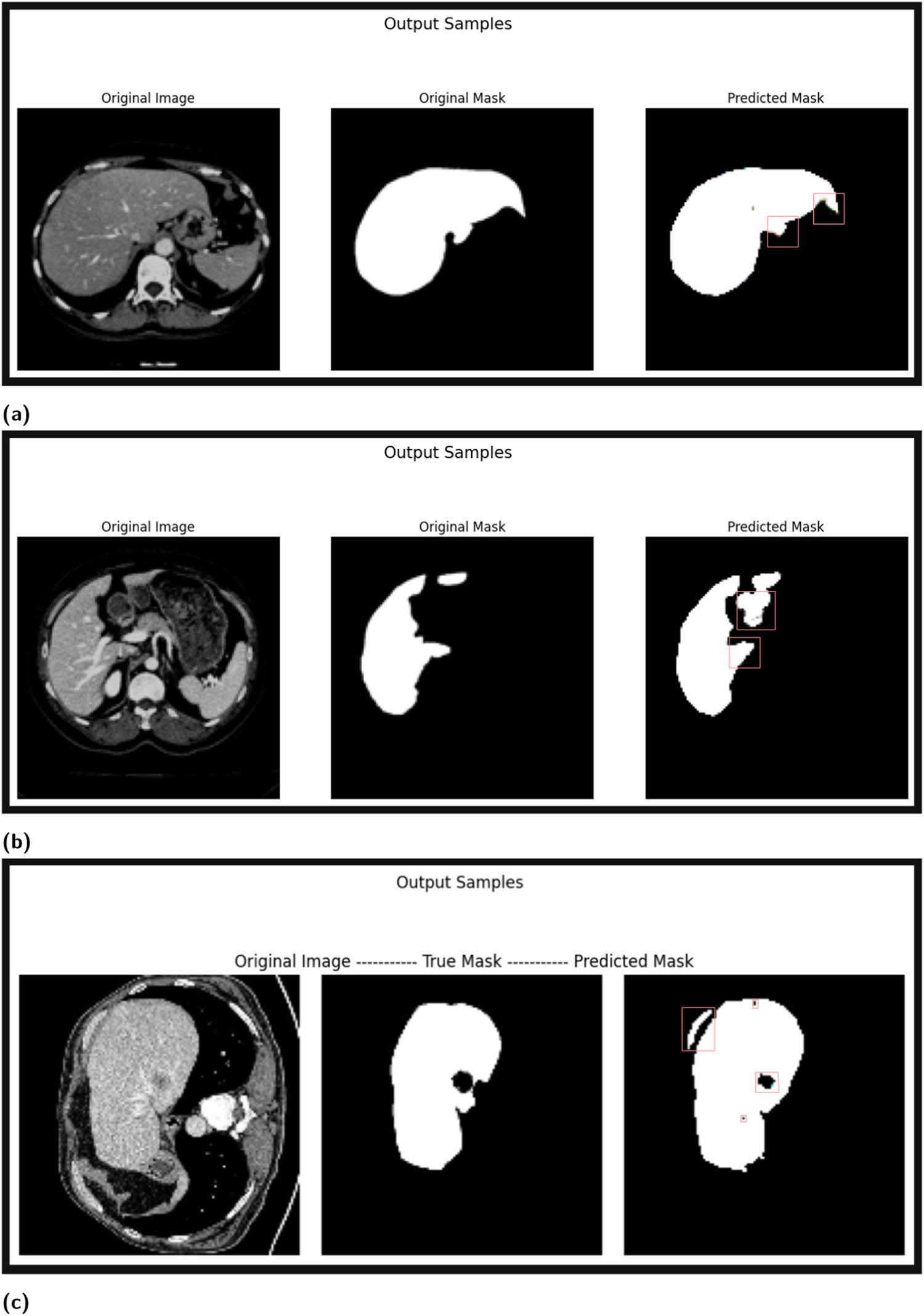 Figure 15 
                  Examples of erroneous outputs for liver segmentation: (a) R2U-Net on the 3DIRCADb dataset, (b) U-Net++ on the CHAOS dataset, and (c) U2-Net on the LiTS dataset. These results highlight the limitations and challenges faced by the models in accurately segmenting certain liver regions in CT images.
               
