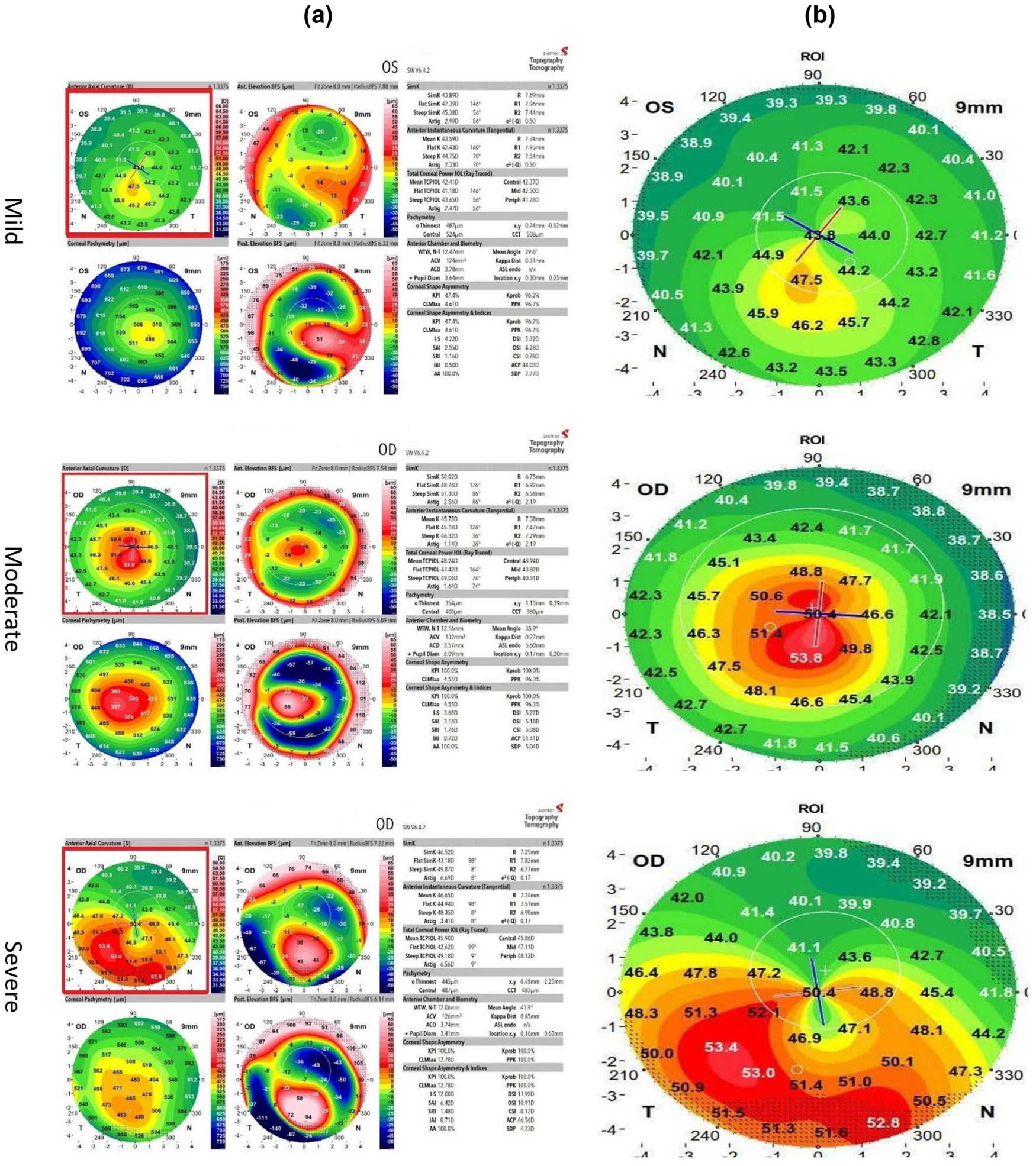 Figure 2
Preprocessing techniques for cases: (a) original image and (b) ROI.