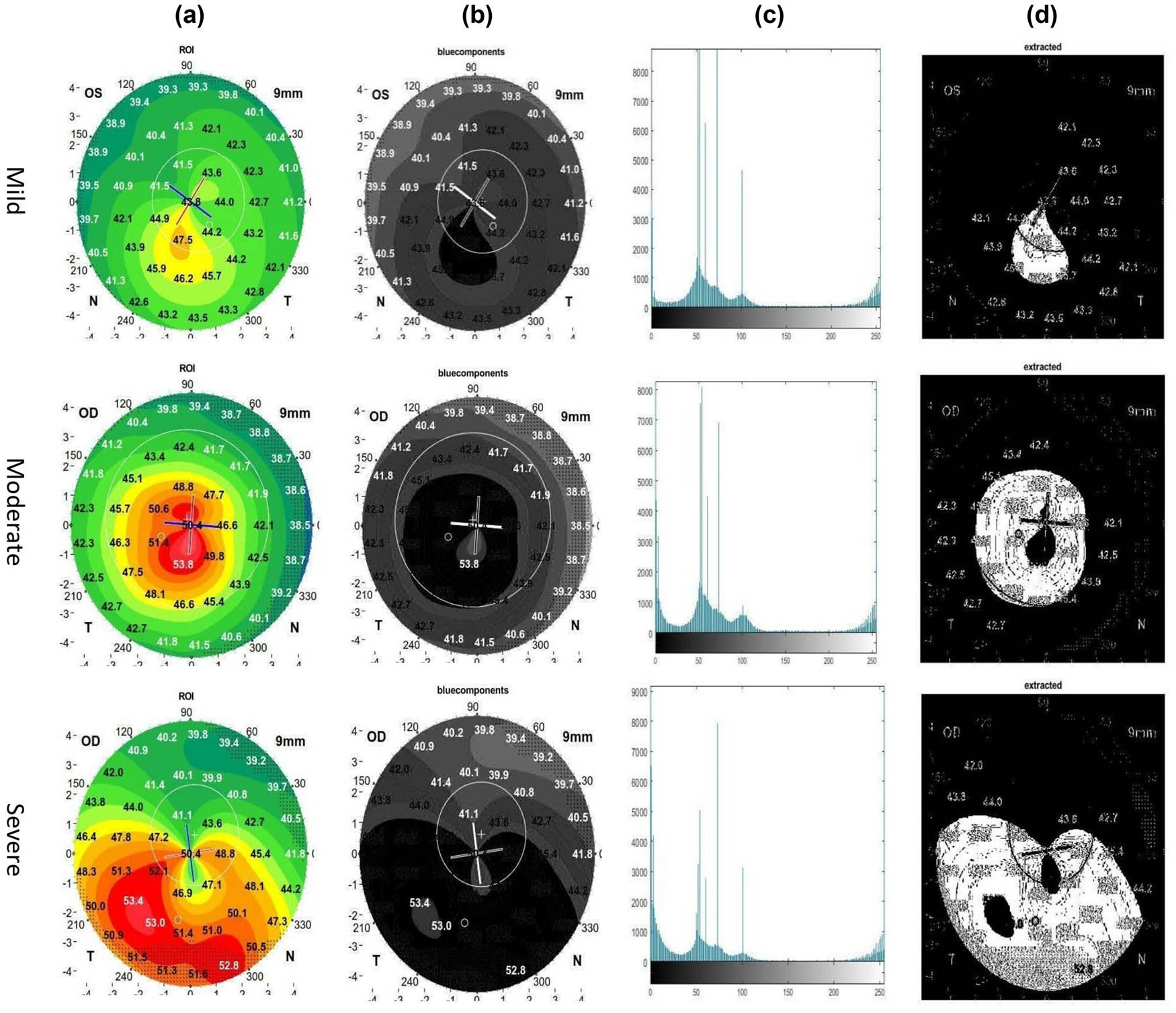 Figure 3
Segmentation techniques for the cases: (a) ROI, (b) blue component, (c) histogram, and (d) extraction.