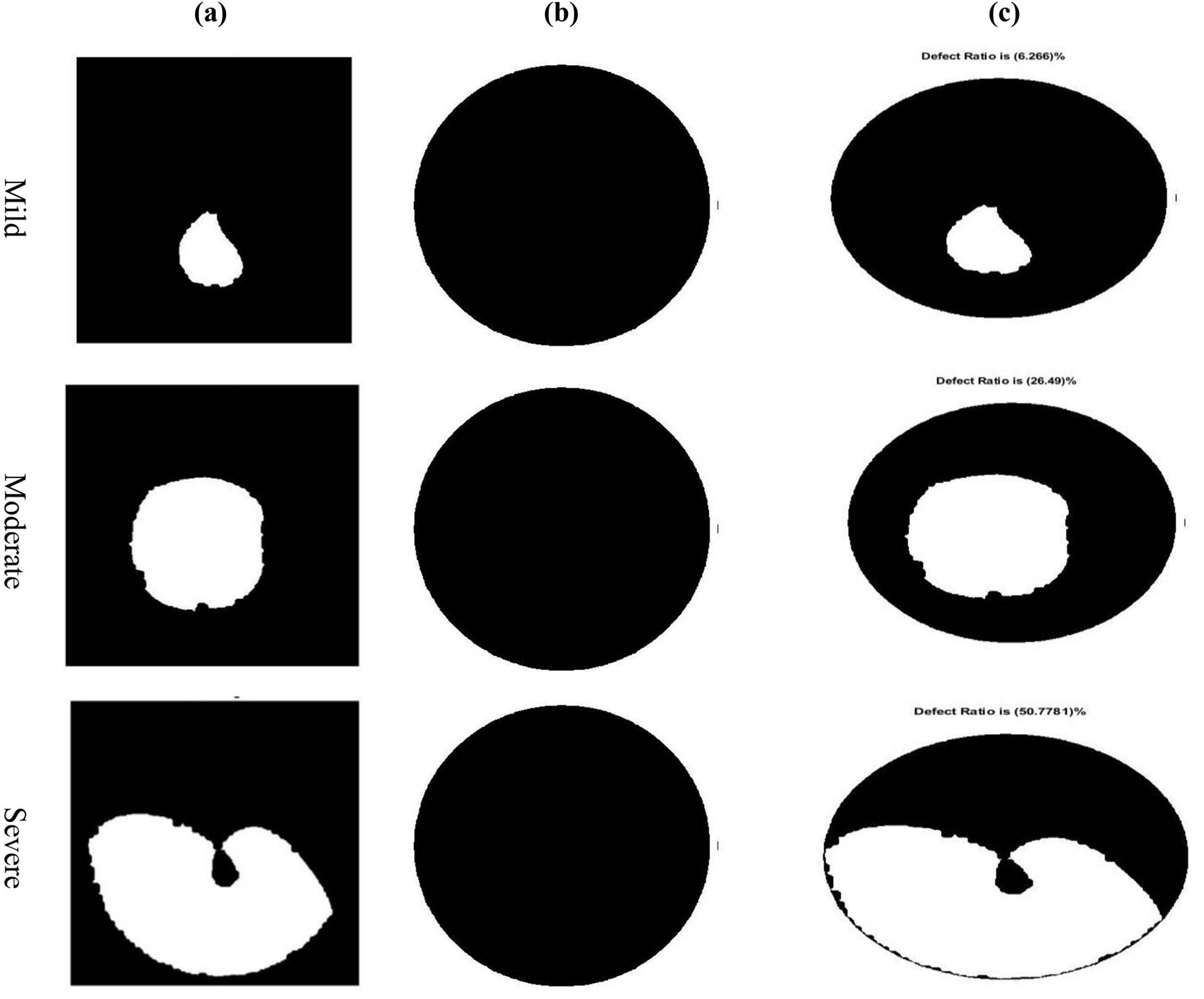 Figure 5
Defect ratio calculation: (a) hole filling image, (b) background image, and (c) final image (defect ratio).