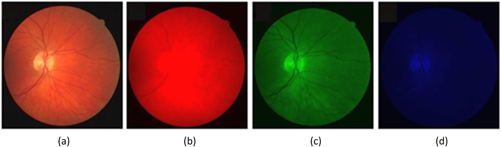 Figure 4 
                  Comparative analysis of a color retinal image with its constituent color channels: (a) original image, (b) red channel, (c) green channel, and (d) blue channel. Images obtained from DRIVE dataset.
               