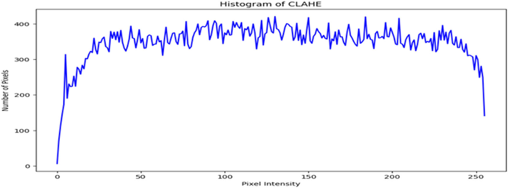 Figure 3 
                  Intensity distribution histogram after applying the CLAHE enhancement technique (created by the authors).
               