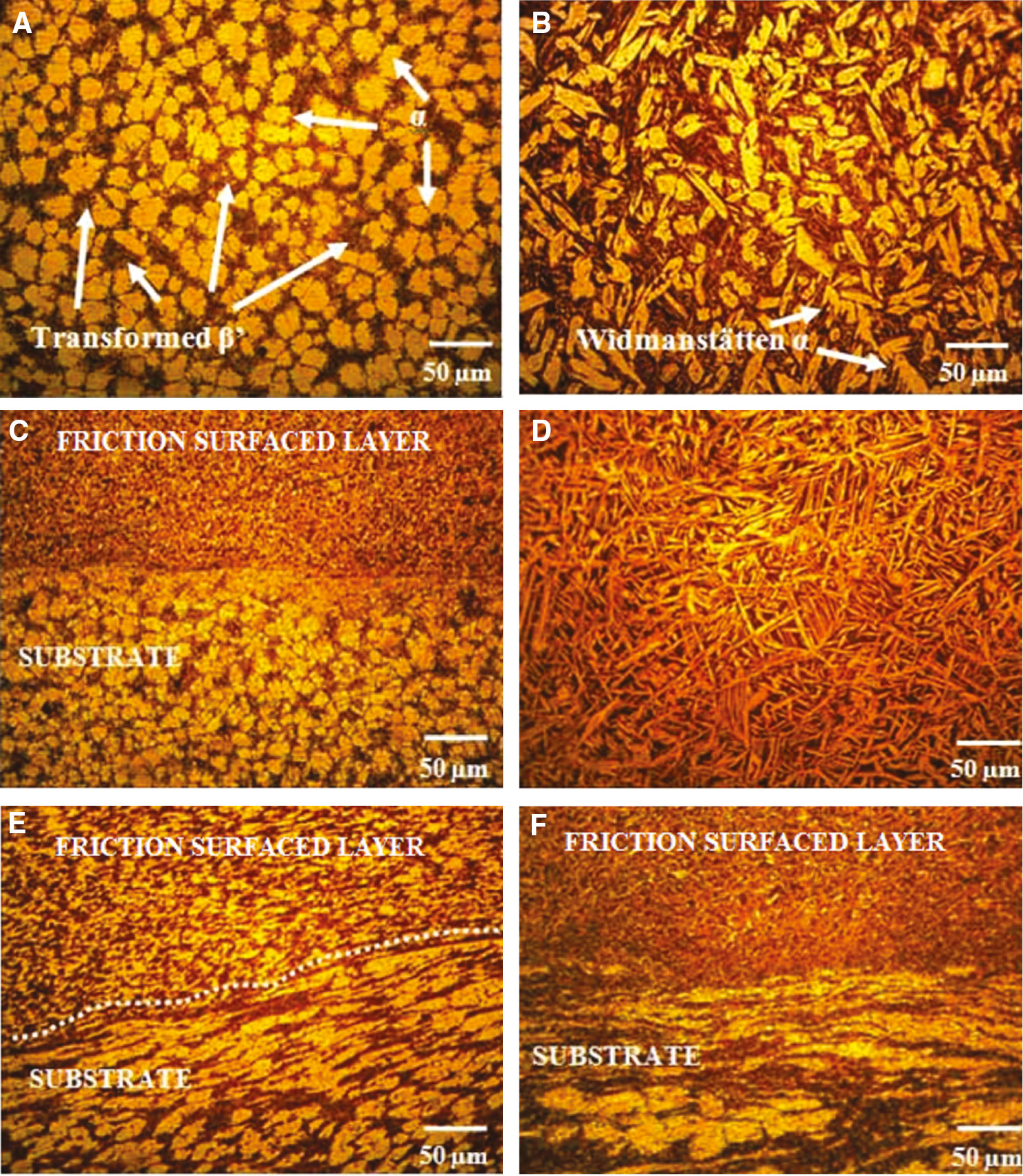Figure 5: Optical microstructures of substrate, mechtrode and friction surfaced interfaces.(A) Base material-cast NAB, (B) mechtrode-extruded NAB, (C) interface-friction surfacing and substrate, (D) unmixed friction surfacing, (E) interface-friction surfacing and substrate, (F) interface-friction surfacing and substrate (α grains and β phase).