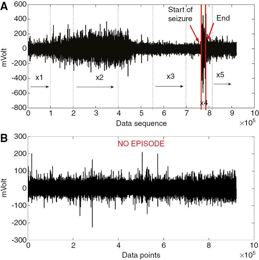 Figure 1: Tsallis q-triplet of two EEG time series concerning epileptic and healthy states.(A) EEG time series including an epileptic episode. The initiation of the episode and its end is denoted by the red vertical lines. (B) EEG time series of the same patient with no episode.