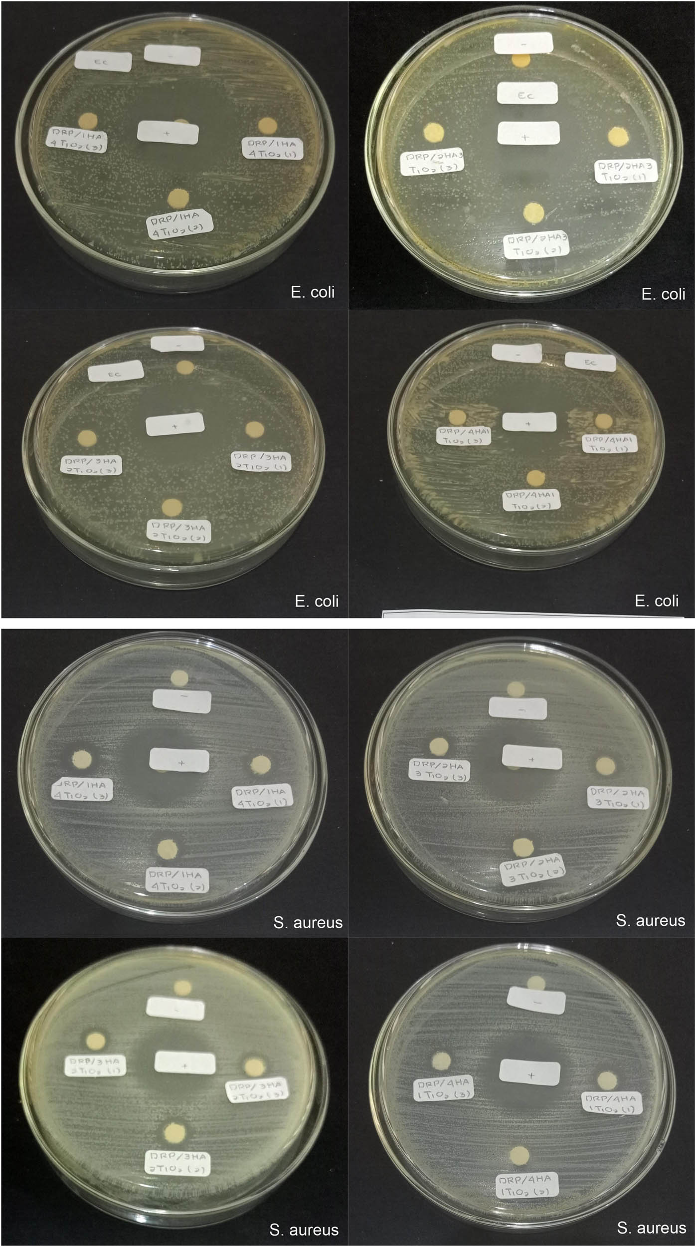 Figure 8
Zone of inhibition of 3D-printing specimens against E. coli and S. aureus bacteria: Control positive (+); control negative (−); DRP with the additive HA–TiO2 at various concentrations.