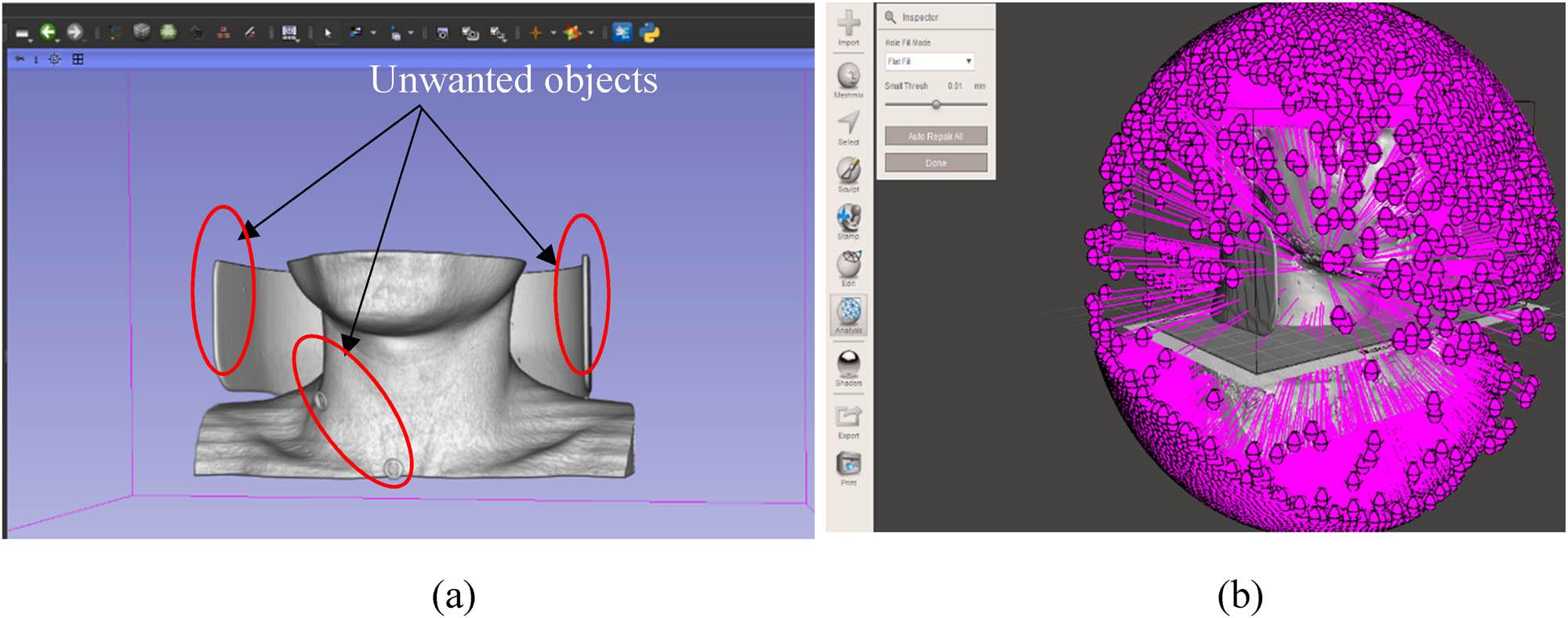 Figure 4 
                     Editing of the cervical region of the model: (a) unwanted objects around the neck region, and (b) open loops identified in.stl file of the neck model.
                  