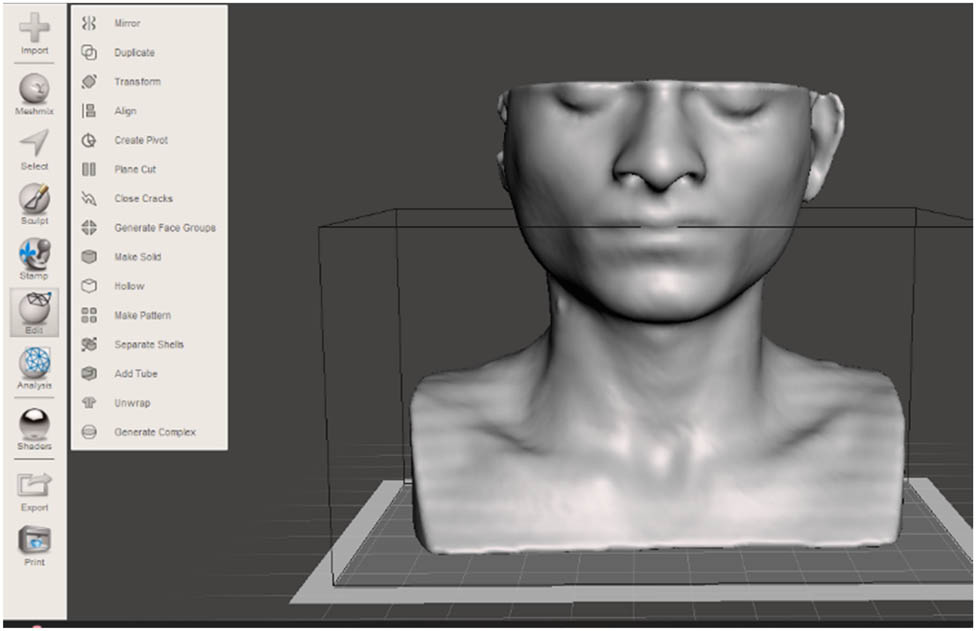 Figure 5 
                     Exported STL file of the neck model after error rectification.
                  