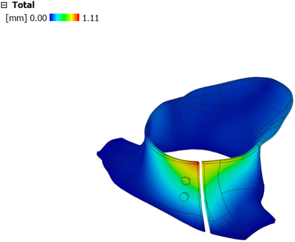 Figure 10 
                     Displacement of the cervical collar.
                  