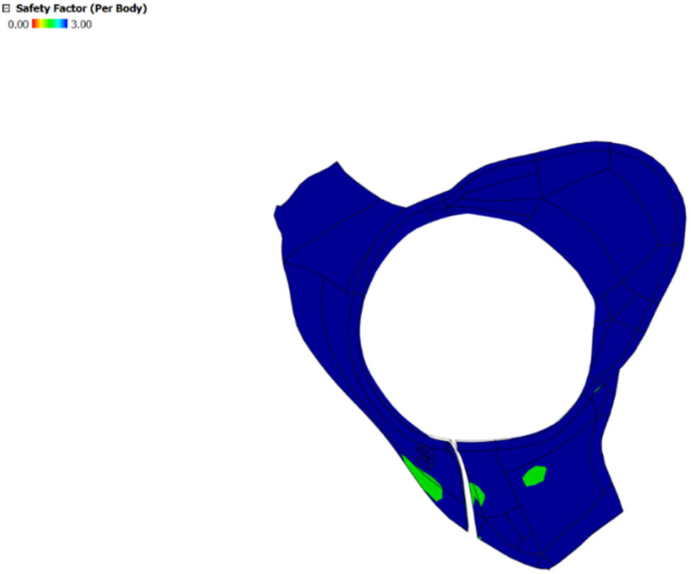 Figure 11 
                     Factor of safety of the cervical collar.
                  