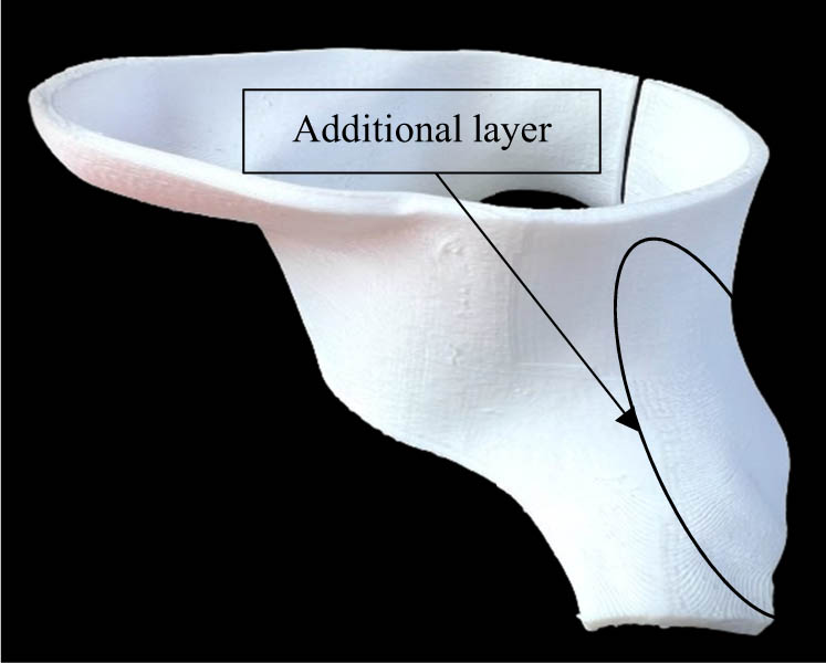 Figure 19 
                     Additional layers in the 3D-printed cervical collar.
                  