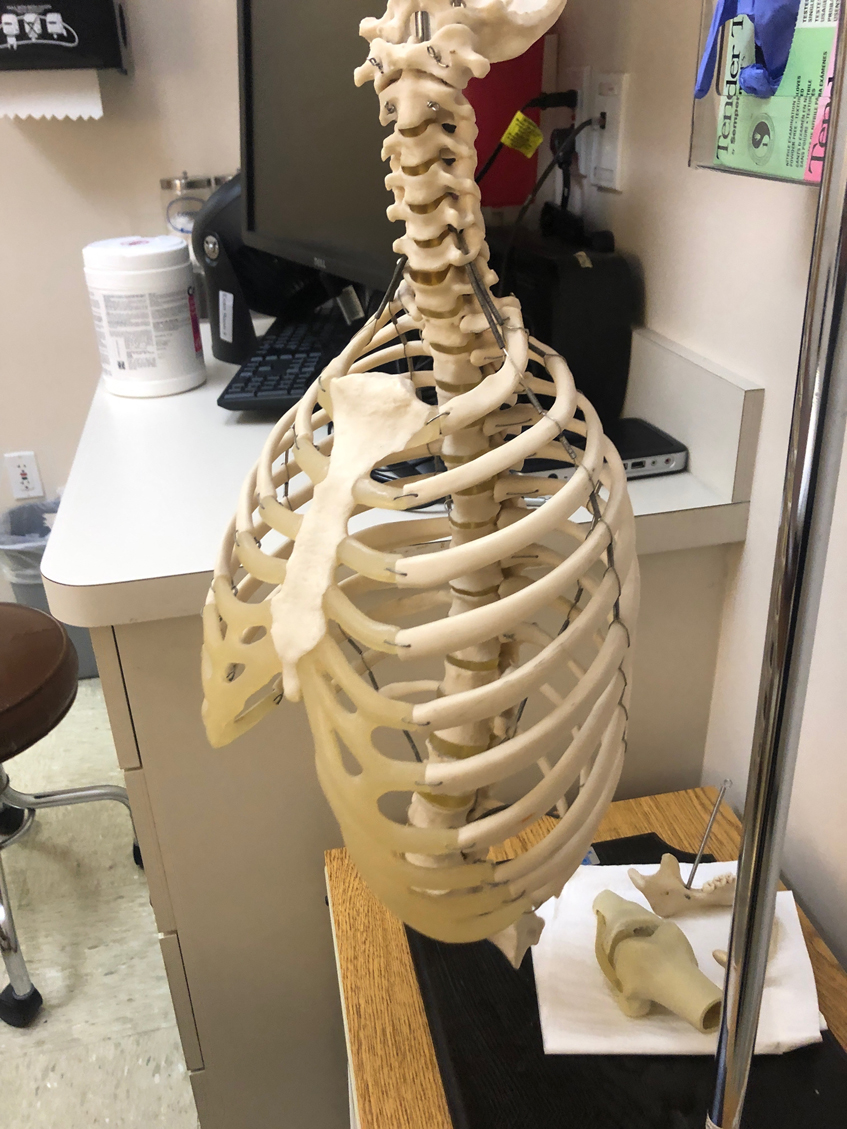 Figure 4: Lateral view of the traditional model.