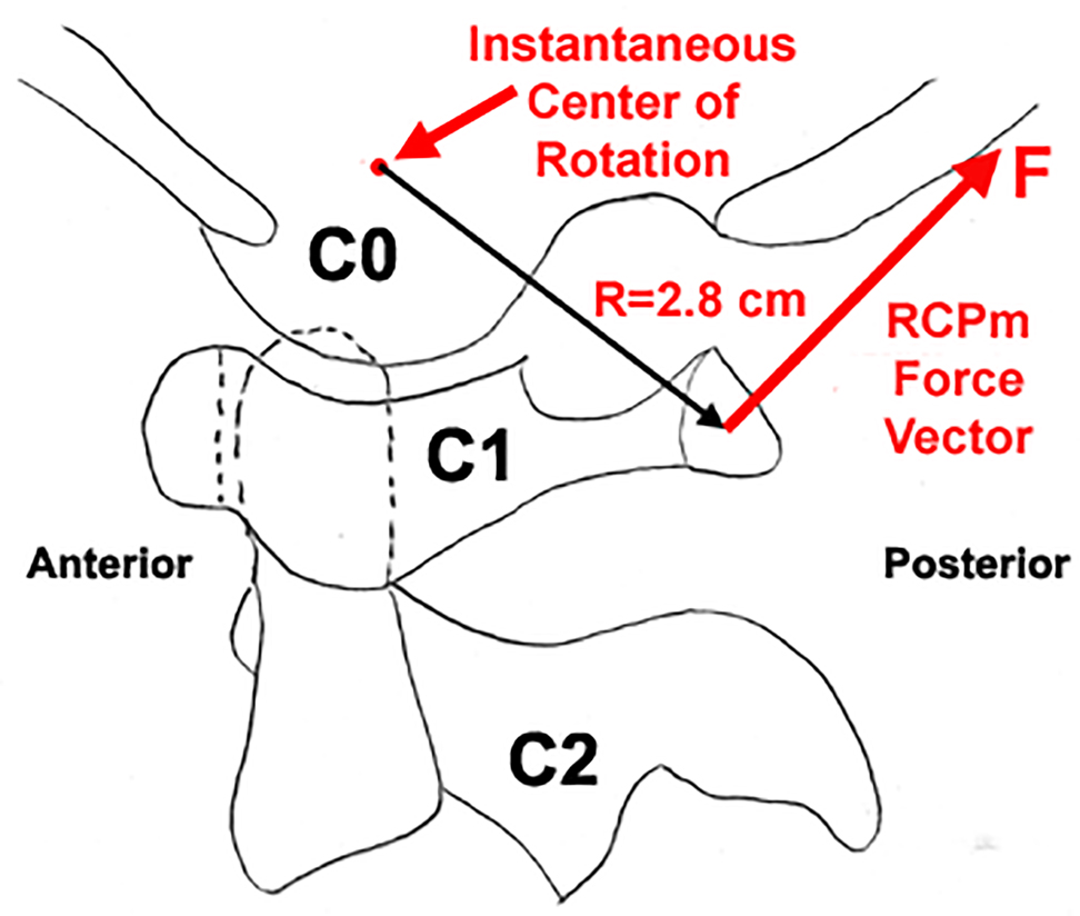 Figure 3: 
Instantaneous axis of rotation of the posterior process of C1 about C0, showing length of moment arm (R).

