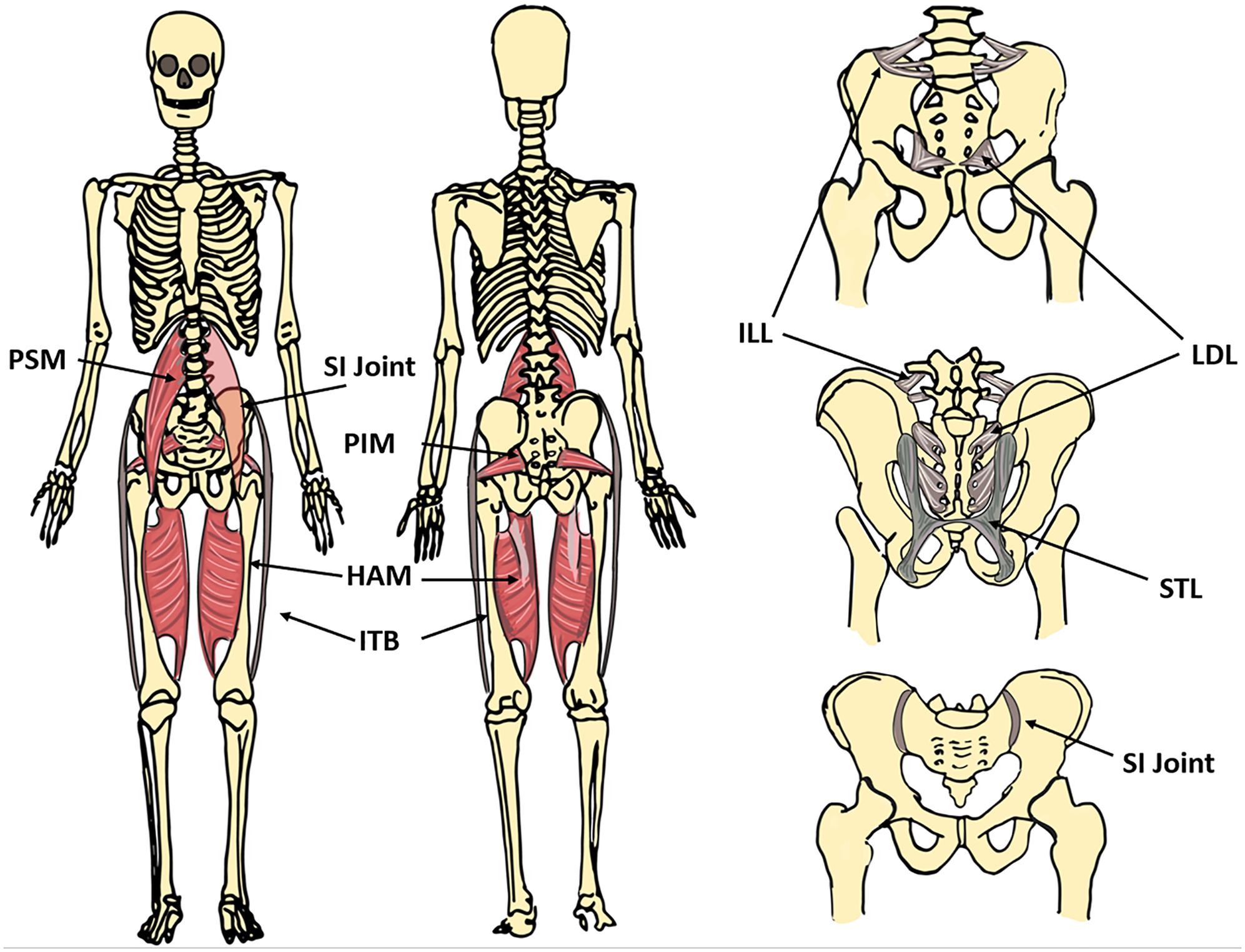 Figure 1:
The sacroiliac (SI) joint and the lumbosacropelvic (LSP) region. The LSP region most closely associated with chronic low back pain (CLBP) includes: iliolumbar ligament (ILL), psoas muscle (PSM), long dorsal ligament (LDL), sacrotuberous ligament (STL), piriformis muscle (PIM), iliotibial (tendon) band (ITB), adductor magnus muscle (hip adductor muscle) (HAM). This area is comprised of the principal pain generators. CLBP, chronic low back pain; HAM, adductor magnus muscle (hip adductor muscle); ILL, iliolumbar ligament; ITB, iliotibial (tendon) band; LDL, long dorsal ligament; LSP, lumbosacropelvic; PIM, piriformis muscle; PSM, psoas muscle; SI, sacroiliac; STL, sacrotuberous ligament.