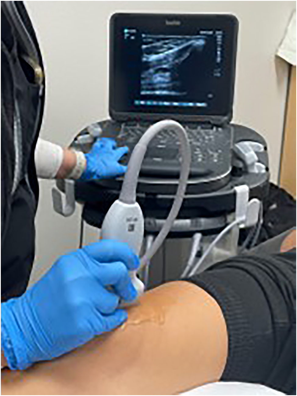 Figure 4:
Point-of-care ultrasound of the anterior knee. Students described the anatomy seen on ultrasound as they scanned the standardized patient’s knee.