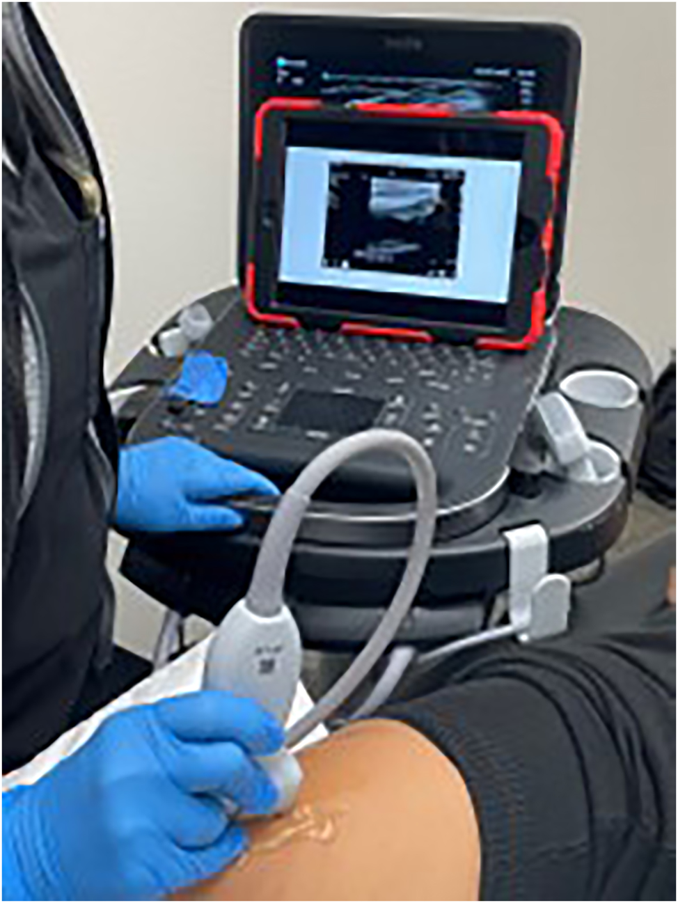 Figure 5:
A novel approach to providing reliable sonographic pathology when scanning a standardized patient. Once students have the correct probe placement and image in view, a digital tablet with the same anatomic view plus one of our three focused pathologies is manually superimposed over the ultrasound screen. Students were asked to consider their probe placement, underlying anatomy, and the image on the “new” screen to make a diagnosis.