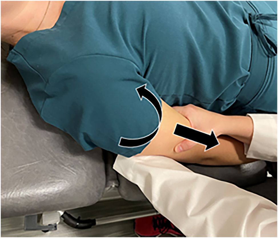 Figure 3:
Internal rotation (curved arrow) and inferior traction (straight arrow) are applied to the arm from holding above the elbow.