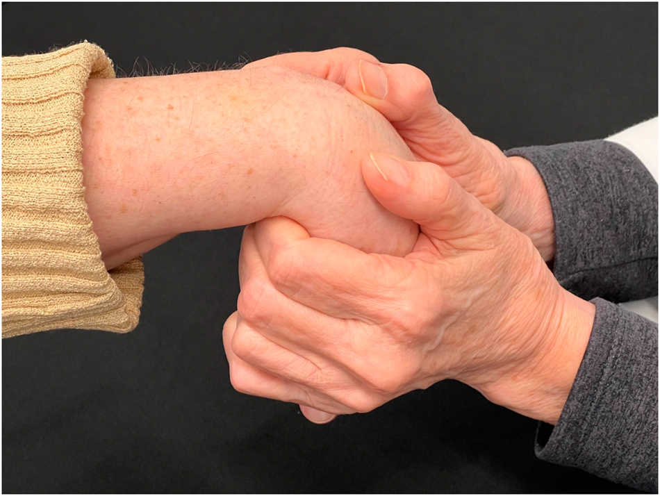 Figure 2:
DCA-ME OMT performed on the wrist. The wrist is flexed to engage the flexion restrictive barrier. The patient makes a fist for 3–5 s, and counterforce is applied. After a pause, the maneuver is repeated, flexing the wrist further with lateral motion to optimize the curvature of the dorsal carpal arch (DCA). After another pause, it is repeated once more.
