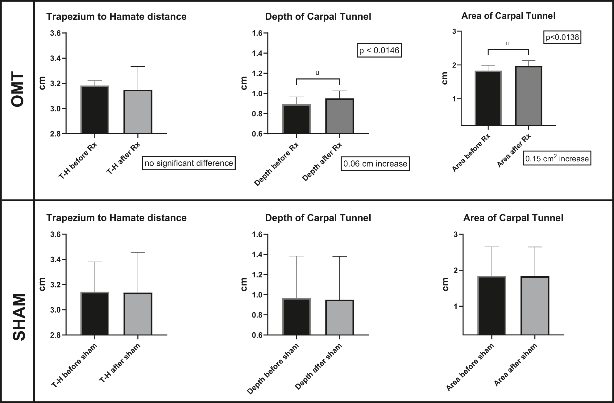 Figure 4:
Comparing the means of measurements made before and after manipulation. The top row shows the results following DCA-ME OMT with no significant difference in the distance from trapezium to hamate (the length of the transverse carpal ligament), a 0.06 cm increase in depth of the carpal tunnel, and a 0.15 cm2 increase in carpal tunnel area. The bottom row shows the results following the sham manipulation with no significant difference between any of the measurements made before and after.