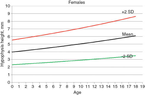 Figure 3 Pituitary height plotted against age for girls.