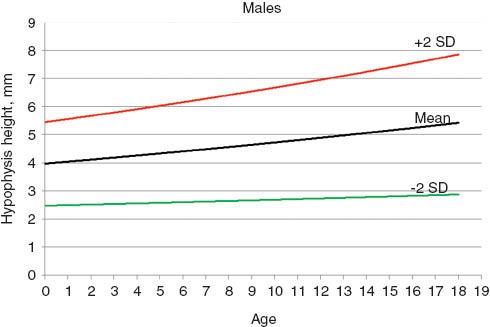 Figure 4 Pituitary height plotted against age for boys.