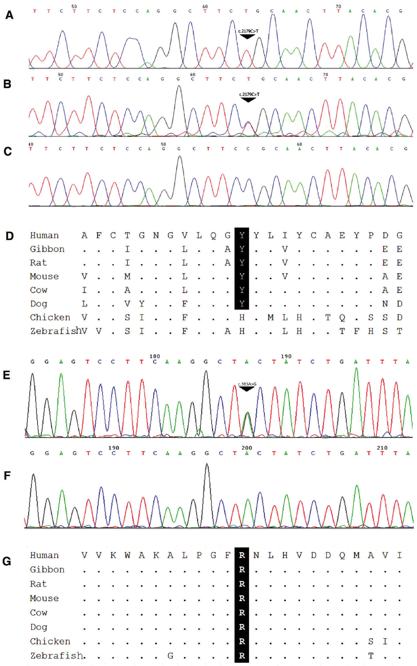 Figure 2: Novel mutations in (A) AR and (B) SRD5A2.(A) Electropherograms showing hemizygous p.R726C of the AR gene in Patient 7 and his heterozygous mother and normal father (B and C), respectively. Comparative genomic analysis showing that p.R726 is conserved among mammalian species (D). The heterozygous SRD5A2 p.Y128C mutation found in Patient 3 (E) compared to normal control (F) and conserved among species (G).