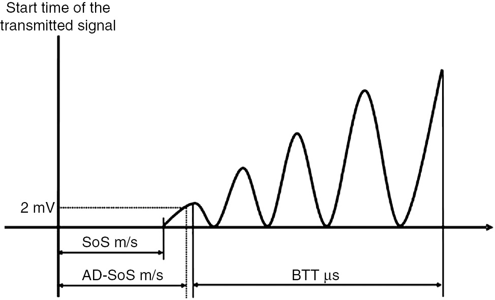 Figure 1: Analysis of the trace of the sound wave to calculate SoS, AD-SoS and BTT (adapted from Baroncelli) [14].