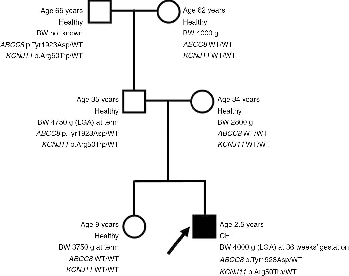 Figure 1: Pedigree of the patient’s family.Arrow, proband; black color, clinical symptoms of CHI; white color, healthy; BW, birth weight; LGA, large for gestational age; WT, wild type (mutation absent).