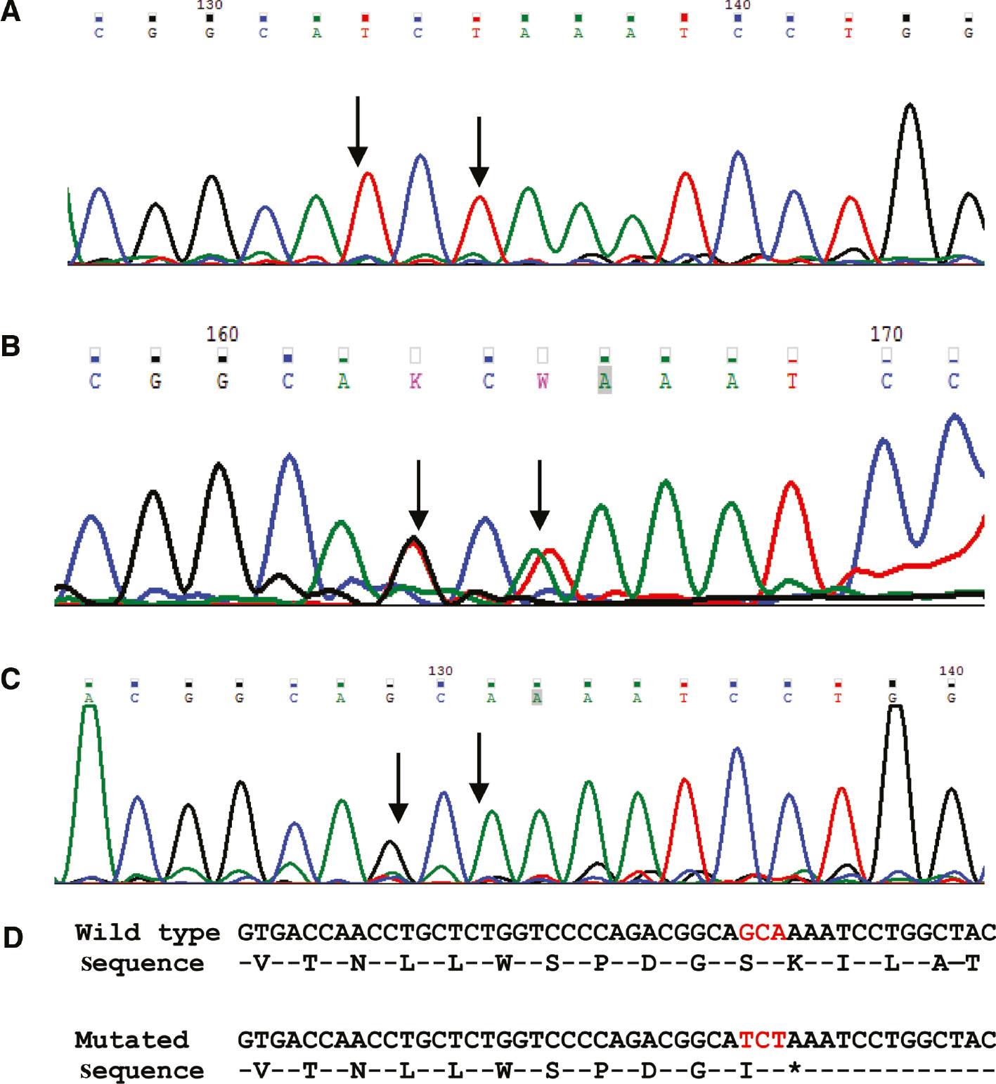 Figure 1: Electropherogram of the novel mutation identified in the AAAS gene (c.899_901delinsTCT).(A) Electropherogram showing homozygous nucleotide changes in the affected child. (B) Electropherogram showing heterozygous nucleotide changes in the mother of affected child. (C) Electropherogram showing normal sequence in a negative control sample (normal individual). (D) Wild type and mutated DNA and amino acid sequence. Arrows denote the position of nucleotide change.