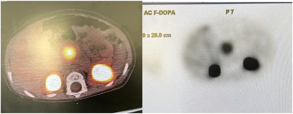 Teaser image from the article