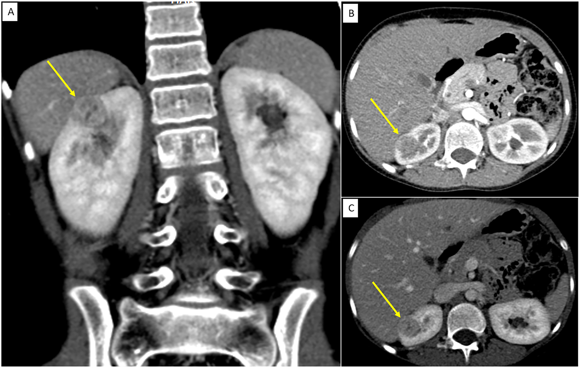 Teaser image from the article