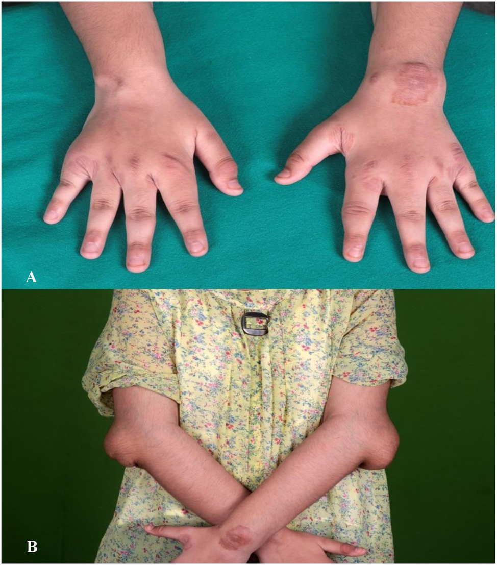 Teaser image from the article