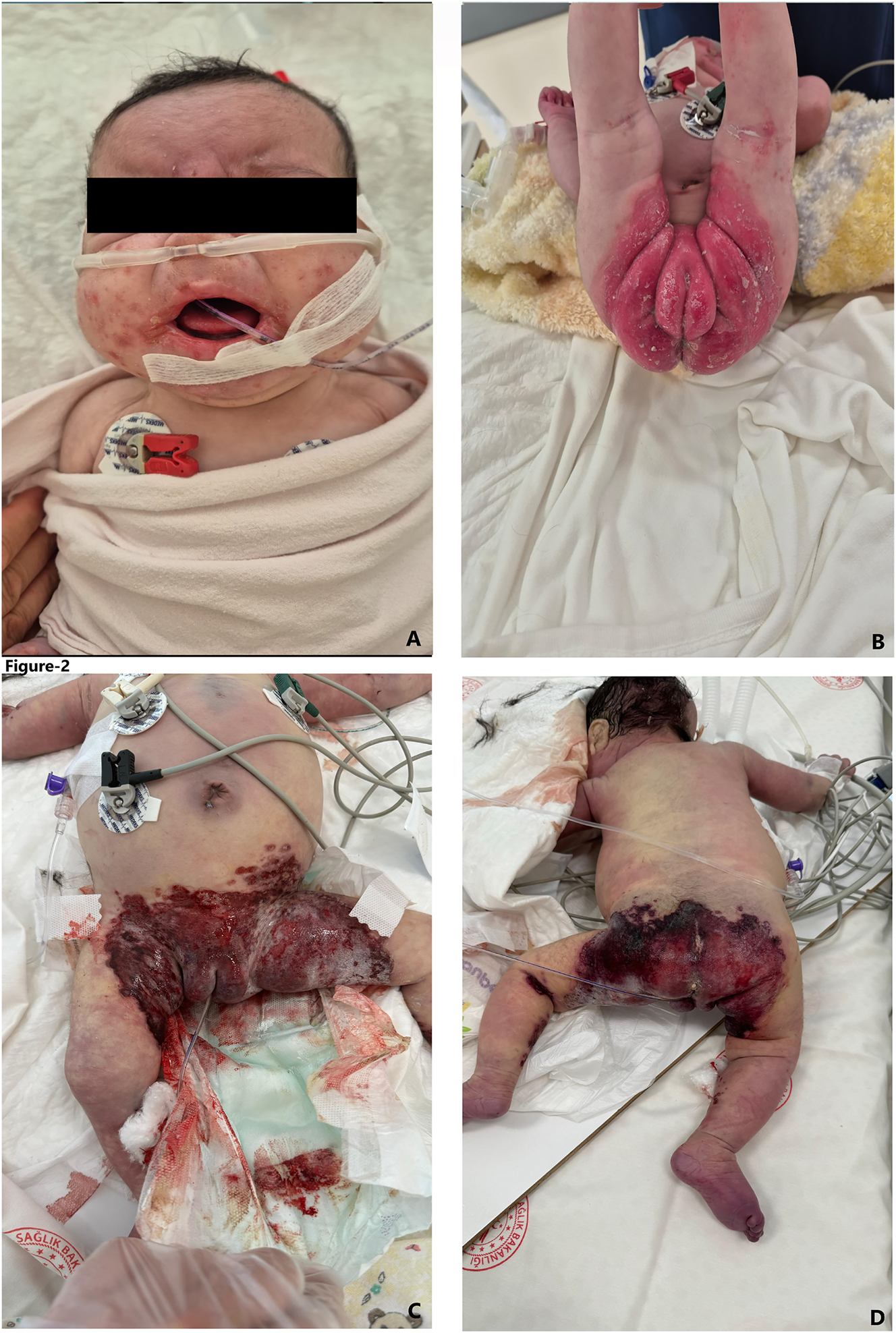 Teaser image from the article