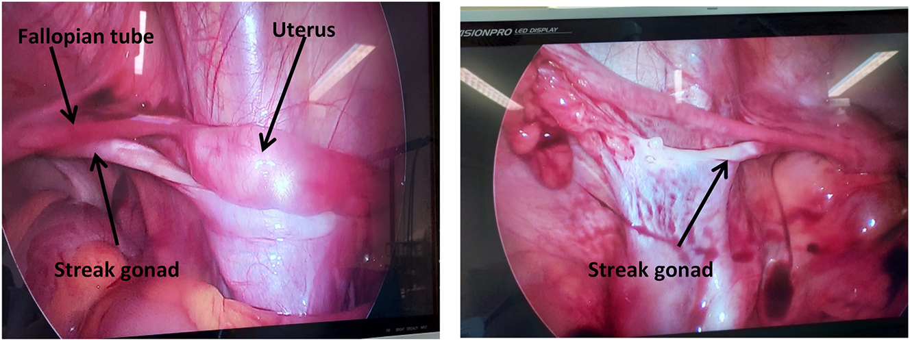 Teaser image from the article