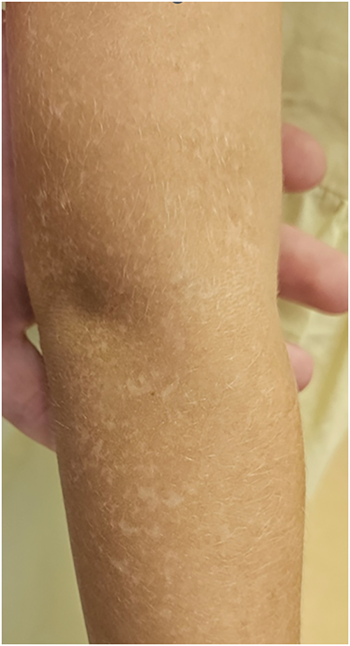 Teaser image from the article