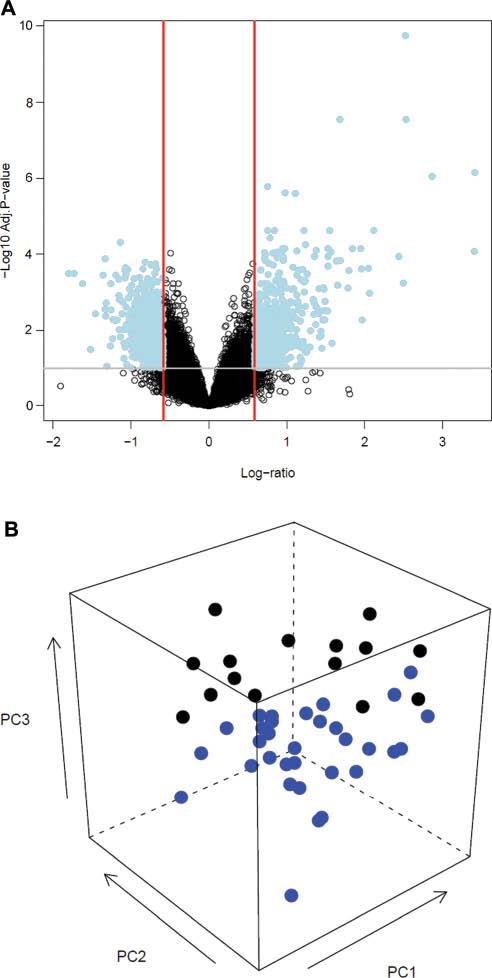 Figure 1 Volcano plot and three dimensional principal component analysis (PCA) plot.(A) The volcano plot shows probability values of all probes in the microarray plotted against the fold change. In this figure, the log (base 10) of the false discovery rate-adjusted probability values are plotted against the log (base 2) of fold change between patients with pyelonephritis and normal controls. On the Y-axis, values higher than the gray-line threshold represent significant probes with an adjusted probability value of <0.1. On the X-axis, values outside the red lines represent fold change >1.5. (B) The three-dimensional PCA plot demonstrates a degree of segregation between women with acute pyelonephritis and normal controls. Blue dots indicate individual samples from the normal control group, whereas black dots represent individual samples from the acute pyelonephritis group.
