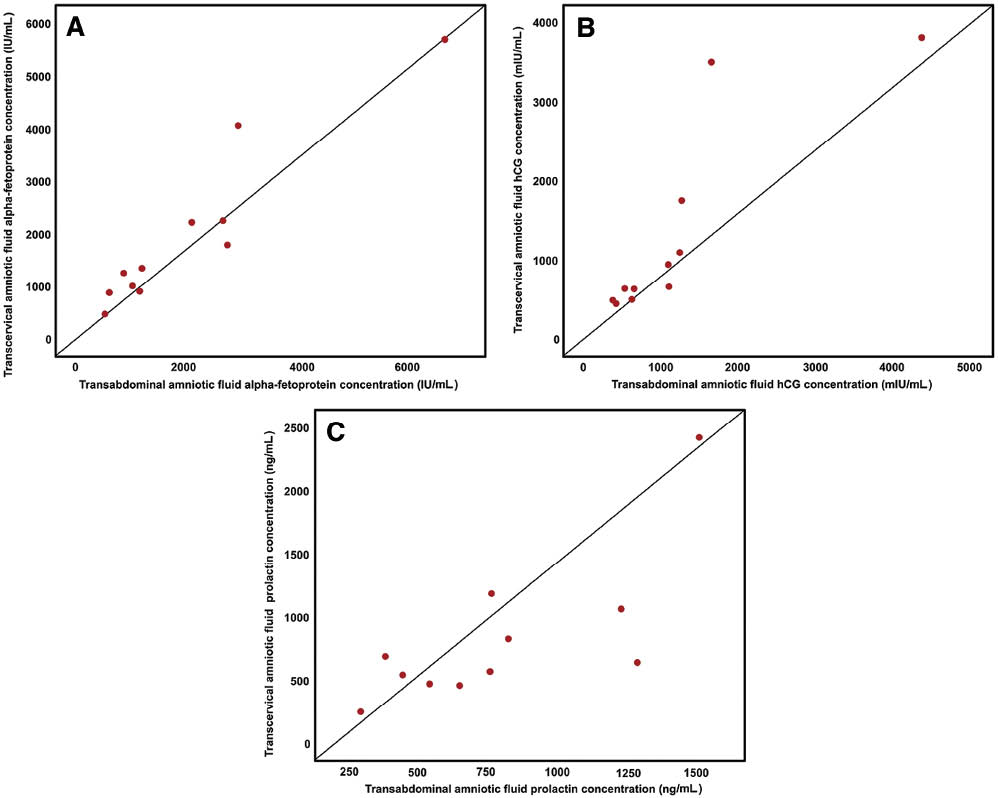 Figure 3 Scatter plot of correlation between protein concentrations in transabdominal amniotic fluid and those in transcervical amniotic fluid. (A) α-Fetoprotein (AFP) (IU/mL); (B) β-human chorionic gonadotrophin (β-hCG) (mIU/mL); (C) prolactin (ng/mL).